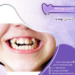 دندان نهفته - دکتر یوسف نژاد