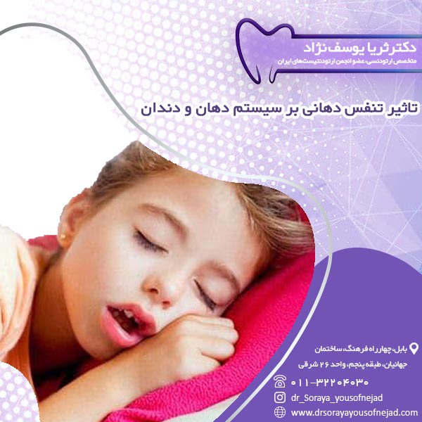 تاثیر تنفس دهانی بر سیستم دهان و دندان