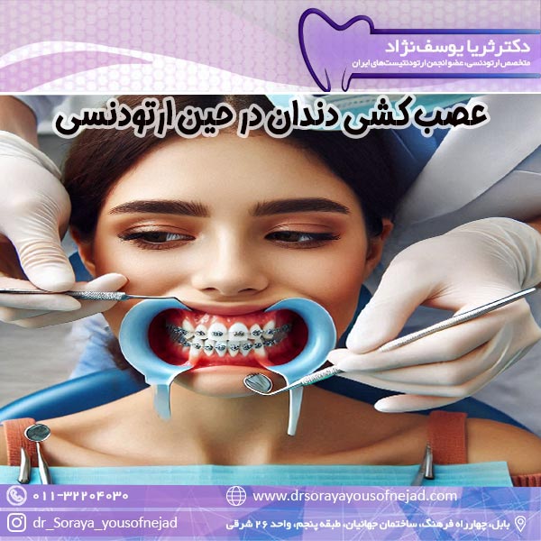 عصب کشی دندان در حین ارتودنسی - دکتر ثریا یوسف نژاد