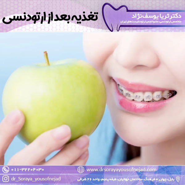 تغذیه بعد از ارتودنسی